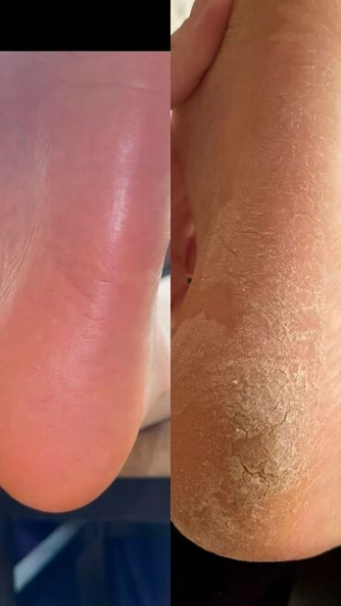 АКЦИЯ, гигиенический педикюр за 1200 сом.! МАНИКЮР ГИГИЕНИЧЕСКИЙ В Бишкек - изображение 4