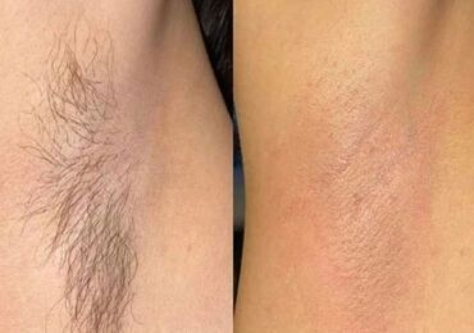 Наращивание ресниц обеспечивает дополнительный объем и длину, создавая Bishkek - photo 3