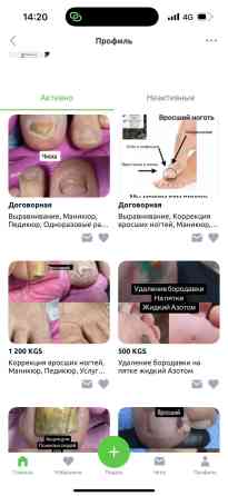 Коррекция вросших ногтей, Маникюр, Педикюр, Услуги подолога, Консультация, Одноразовые расходные материалы Бишкек