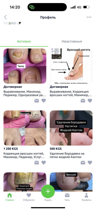 Коррекция вросших ногтей, Маникюр, Педикюр, Услуги подолога, Консультация, Одноразовые расходные материалы Бишкек - сүрөт 1