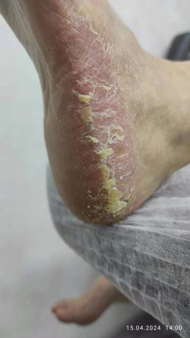 Выравнивание, Наращивание ногтей, Донаращивание ногтей, Маникюр, Педикюр, Услуги подолога, С выездом на дом, Консультация, Одноразовые расходные матер Бишкек - сүрөт 5