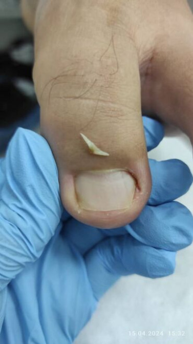 Выравнивание, Наращивание ногтей, Донаращивание ногтей, Маникюр, Педикюр, Услуги подолога, С выездом на дом, Консультация, Одноразовые расходные матер Бишкек - сүрөт 8