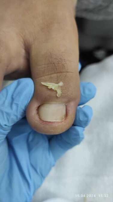 Выравнивание, Наращивание ногтей, Донаращивание ногтей, Маникюр, Педикюр, Услуги подолога, С выездом на дом, Консультация, Одноразовые расходные матер Бишкек - сүрөт 7