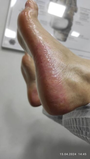 Выравнивание, Наращивание ногтей, Донаращивание ногтей, Маникюр, Педикюр, Услуги подолога, С выездом на дом, Консультация, Одноразовые расходные матер Бишкек - сүрөт 6