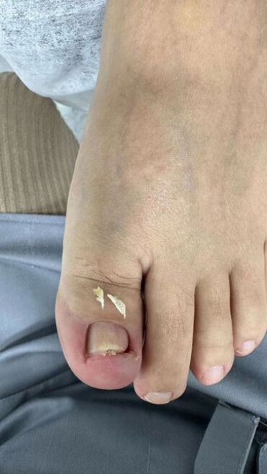 Выравнивание, Наращивание ногтей, Донаращивание ногтей, Маникюр, Педикюр, Услуги подолога, С выездом на дом, Консультация, Одноразовые расходные матер Бишкек - сүрөт 4