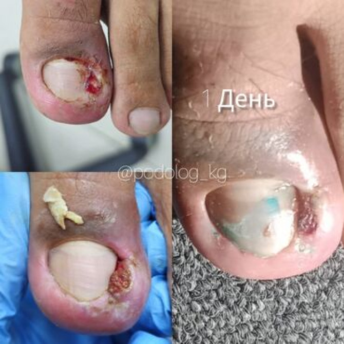 Выравнивание, Наращивание ногтей, Донаращивание ногтей, Маникюр, Педикюр, Услуги подолога, С выездом на дом, Консультация, Одноразовые расходные матер Бишкек - сүрөт 2