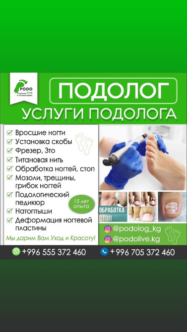 Коррекция вросших ногтей, Услуги подолога, Консультация Бишкек - изображение 1