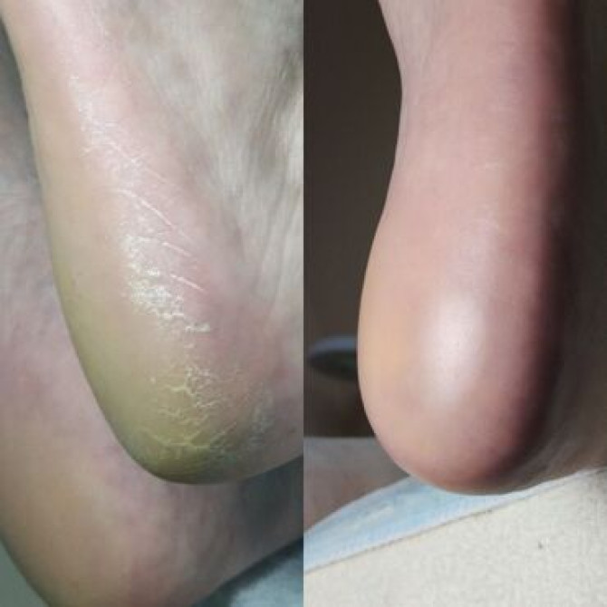 Услуги подолога, С выездом на дом Бишкек - сүрөт 2