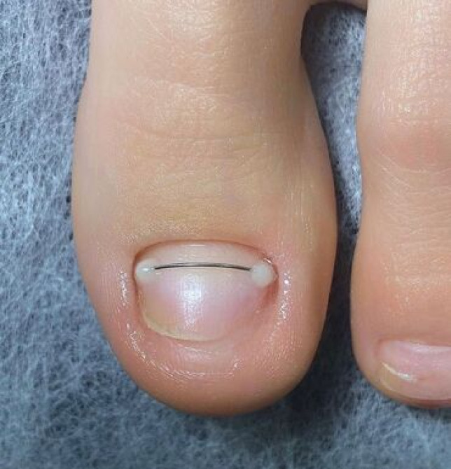 Услуги подолога, С выездом на дом Бишкек - сүрөт 1