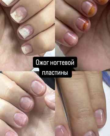 Выравнивание, Маникюр, Педикюр, Услуги подолога, Консультация, Одноразовые расходные материалы Бишкек