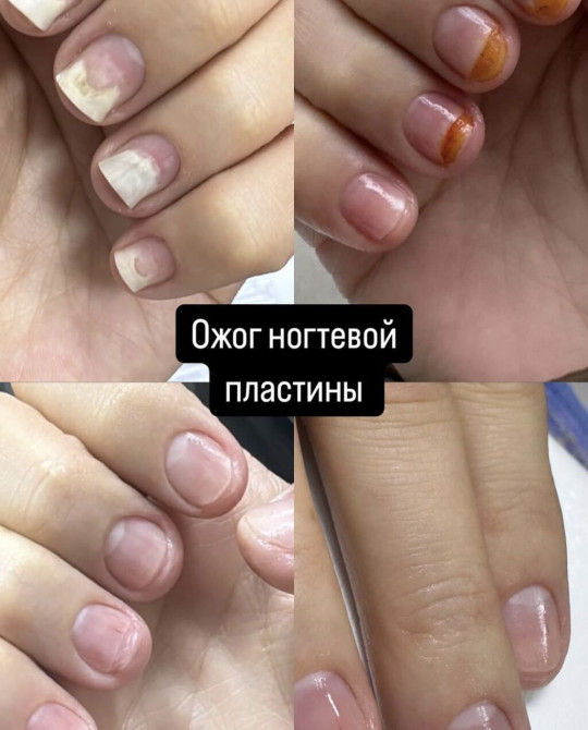 Выравнивание, Маникюр, Педикюр, Услуги подолога, Консультация, Одноразовые расходные материалы Бишкек - изображение 1