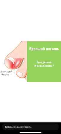 Коррекция вросших ногтей, Услуги подолога, Консультация, Одноразовые расходные материалы Бишкек