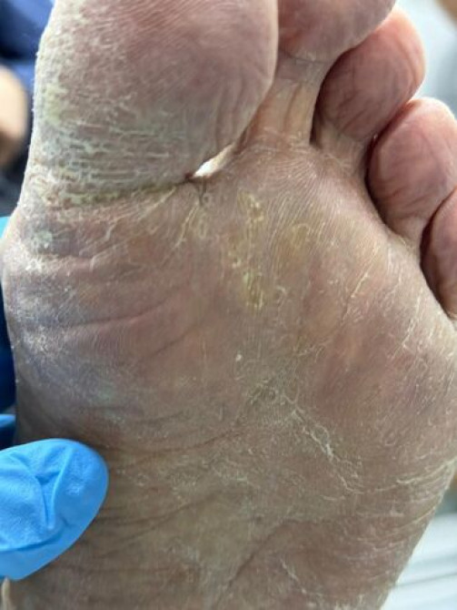 Выравнивание, Наращивание ногтей, Гель лак, шеллак, Маникюр, Педикюр, Услуги подолога, Консультация, Одноразовые расходные материалы, Требуются модели Бишкек - сүрөт 3