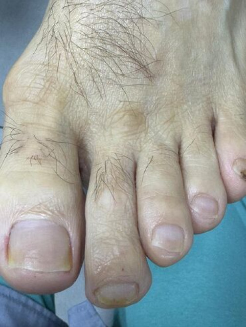 Выравнивание, Наращивание ногтей, Гель лак, шеллак, Маникюр, Педикюр, Услуги подолога, Консультация, Одноразовые расходные материалы, Требуются модели Бишкек - сүрөт 6