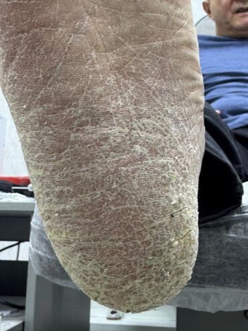 Выравнивание, Наращивание ногтей, Гель лак, шеллак, Маникюр, Педикюр, Услуги подолога, Консультация, Одноразовые расходные материалы, Требуются модели Бишкек - сүрөт 1