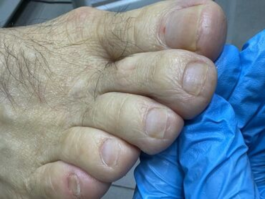 Выравнивание, Наращивание ногтей, Гель лак, шеллак, Маникюр, Педикюр, Услуги подолога, Консультация, Одноразовые расходные материалы, Требуются модели Бишкек - сүрөт 7