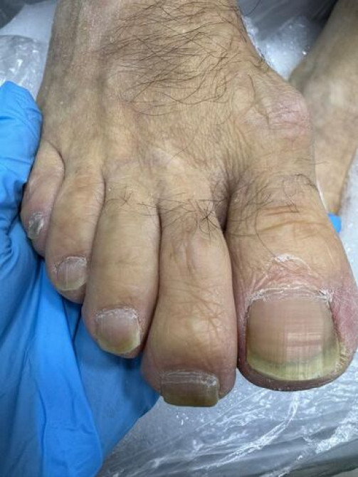 Выравнивание, Наращивание ногтей, Гель лак, шеллак, Маникюр, Педикюр, Услуги подолога, Консультация, Одноразовые расходные материалы, Требуются модели Бишкек - сүрөт 5