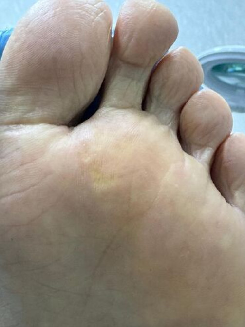 Выравнивание, Наращивание ногтей, Гель лак, шеллак, Маникюр, Педикюр, Услуги подолога, Консультация, Одноразовые расходные материалы, Требуются модели Бишкек - сүрөт 4