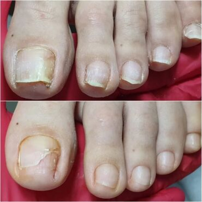 Выравнивание, Дизайн, Донаращивание ногтей, Маникюр, Педикюр, Услуги подолога, С выездом на дом, Консультация, Одноразовые расходные материалы Бишкек - изображение 2