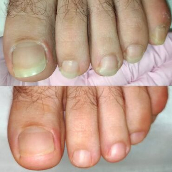 Выравнивание, Дизайн, Донаращивание ногтей, Маникюр, Педикюр, Услуги подолога, С выездом на дом, Консультация, Одноразовые расходные материалы Бишкек - изображение 3